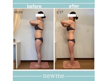 ニュウミー 諏訪本店(newme)/お客様ビフォーアフター