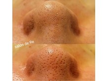 サロンドリー(salon de Re)/超音波エクストラクション