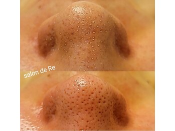 サロンドリー(salon de Re)/超音波エクストラクション