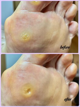 ラヴィ(La vie)/旅行へ行く前に…