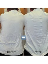 カイロプラクティック ネクサス/背中のねじれと強めの腰痛撃退☆