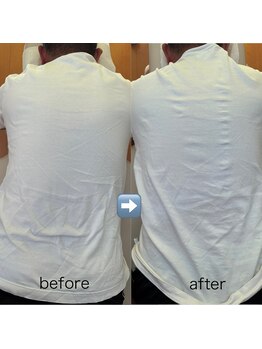 カイロプラクティック ネクサス/背中のねじれと強めの腰痛撃退☆