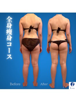 リアン(Lian)/【骨格や姿勢を綺麗にしたい！】