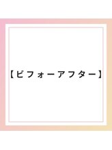 ブレア 銀座/BeforeAfter【鍼灸/カッピング】