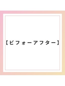 ブレア 銀座/BeforeAfter【鍼灸/カッピング】