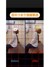 ヒデ整体院(Hide整体院)/猫背矯正骨盤矯正B/A肩こり腰痛