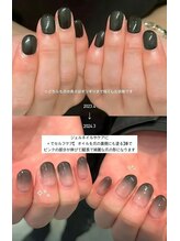 ネイルマン 横浜店(Nail Man)/自爪の育成/ビフォー＆アフター