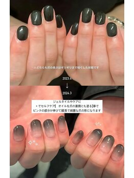 ネイルマン 横浜店(Nail Man)/自爪の育成/ビフォー＆アフター