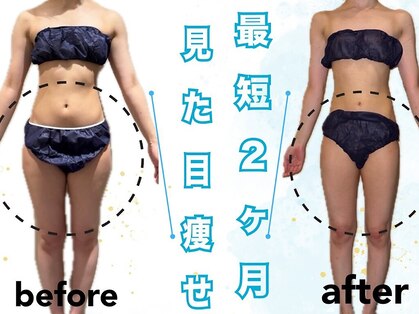 ビオール 新宿店(beall)の写真