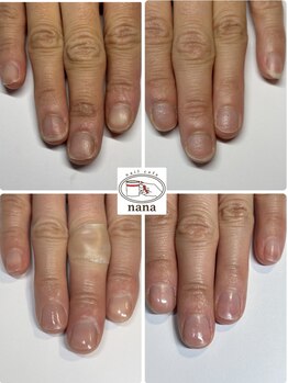 ネイルカフェ ナナ(nailcafe'nana)/自爪育成