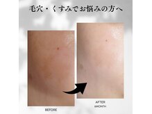 マリン(MARINE)の雰囲気（毛穴・くすみでお悩みの方へ）