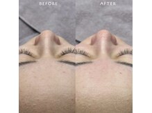 ホワイトワックス 浜松(WHITE WAX)/素肌が垢抜け