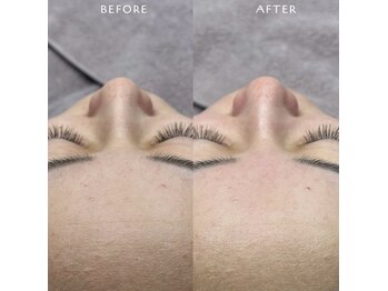 ホワイトワックス 浜松(WHITE WAX)/素肌が垢抜け