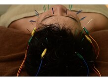 シン(SHINE)/美容鍼灸　頭皮鍼