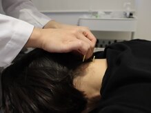 ビーロイヤル(B-ROYAL)/首後ろにもしっかりアプローチ