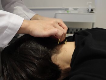 ビーロイヤル(B-ROYAL)/首後ろにもしっかりアプローチ