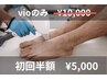 初回半額　「メンズVIO脱毛　」¥10.000→¥5.000税込