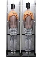 足立カイロプラクティック/姿勢分析器でバランスチェック