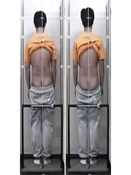 足立カイロプラクティック/姿勢分析器でバランスチェック