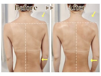 セッテベレッザ(Sette Bellezza)/強力痩身でくびれづくり