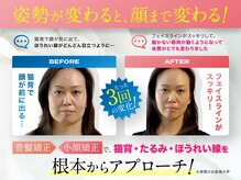 理想の小顔 江坂店