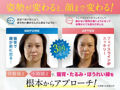 理想の小顔 江坂店の写真