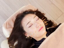 【定額制の美容鍼サロン小顔・整体】ハリナチュレ横浜駅前店