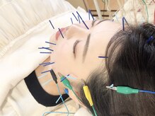 瑞 鍼灸院/美容施術♪