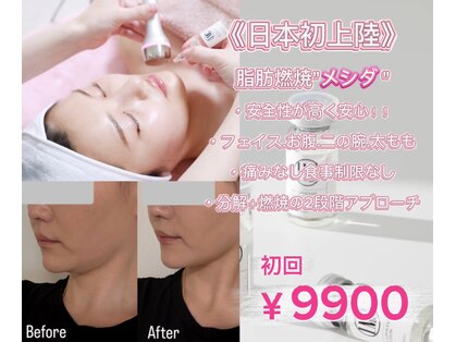ソルティ サロン(salty salon)の写真