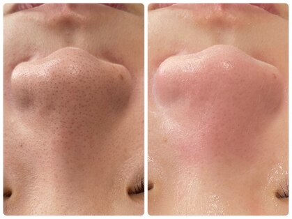 ラヴィ(Ravi)の写真