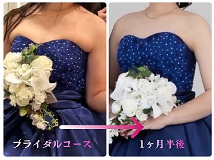 プリヴィエレジェ(privilegie)の写真