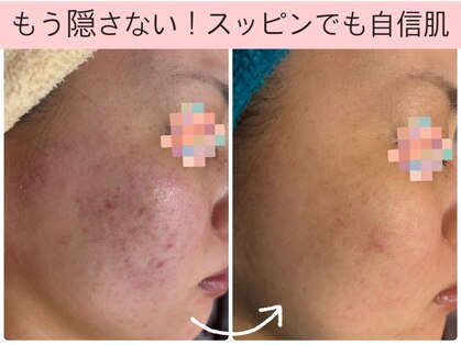 トータルビューティー ココ(Total Beauty CoCo)の写真