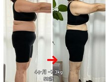 ふーみん/食欲と自律神経を整える