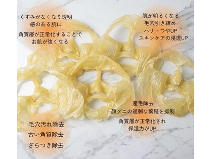 ステラ(Stella)の写真