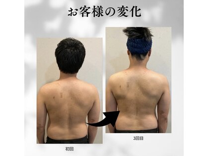 小顔フェイスラボ 一宮店(小顔 Face Labo.)の写真