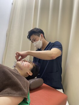 けいのき鍼灸整骨院/美容鍼/ニキビケア/鍼/小顔/毛穴