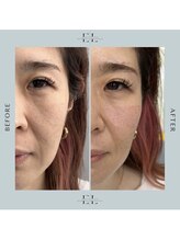 スプレール 水戸店/ExoLif（エクソリフト）