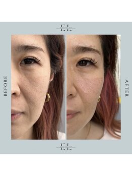 スプレール 水戸店/ExoLif(エクソリフト)