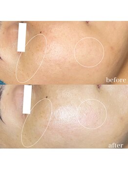 ちらちゅら/イラストリアス