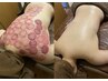 【人気No.1】マッサージの3倍ほぐれる！全身デトックス温かっさ カッピング付
