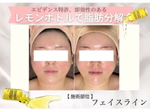 フェアリー 小松店/レモンボトル導入店♪