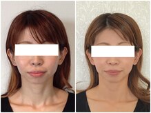 ウェリナ平和堂長久手院/小顔矯正/骨盤矯正/美脚サロン