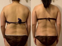 グランディール(GRANDIR)/上半身コース5回