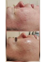 ロータスマップ(LOTUS MAP)/