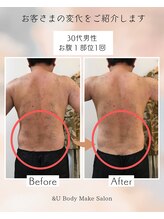 アンドユー(&U)/