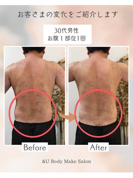 アンドユー(&U)/