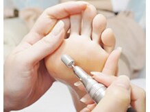 足爪甘皮処理＋足裏角質処理の大変珍しい組み合わせのフットケア