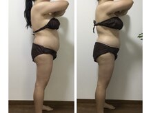 エフハリスト 表参道 外苑前(Efcharisto`)/before after お腹痩