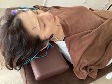 ハリファ鍼灸院 横浜関内院(HariFa鍼灸院)/美容鍼施術/美容鍼