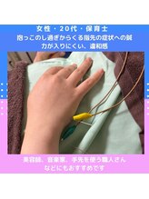 フラット柏(FLAT柏)/手・指の症状への鍼【鍼灸・整体